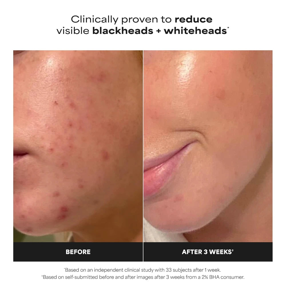 Paula's Choice Liquid Exfoliate