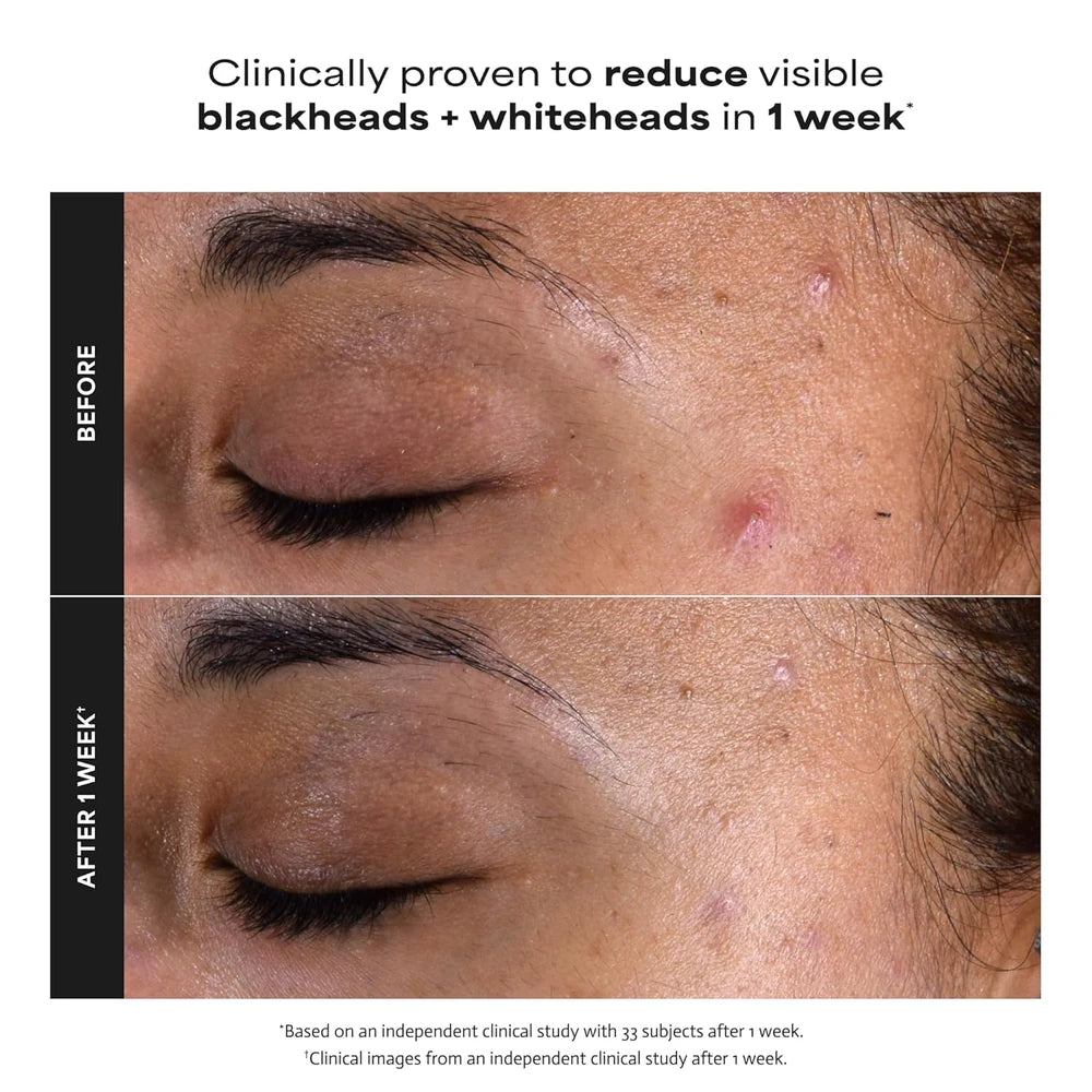 Paula's Choice Liquid Exfoliate