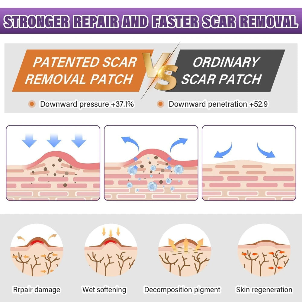 Medical Grade Silicone Scar Sheets