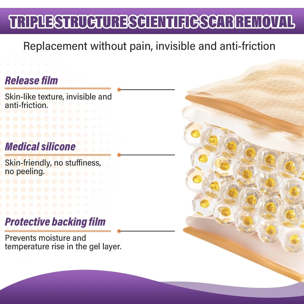 Medical Grade Silicone Scar Sheets